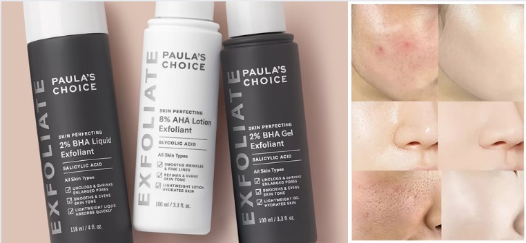 using the Paula's Choice Skin Perfecting 2% BHA Liquid Exfoliant