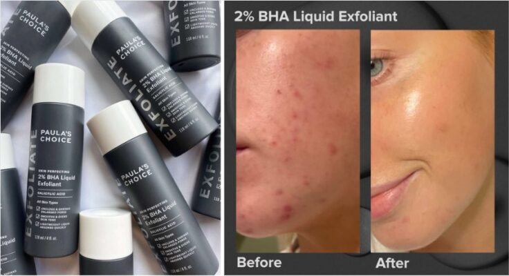 Paula's Choice Skin Perfecting 2% BHA Liquid Exfoliant: An In-Depth Review